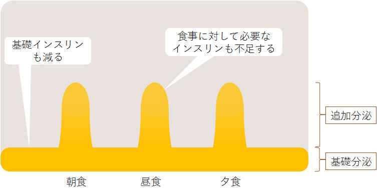 インスリン注射の分類